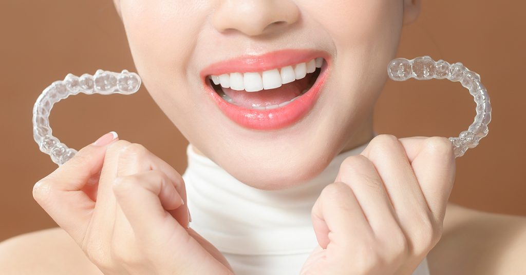 SG 牙齿矫正推荐