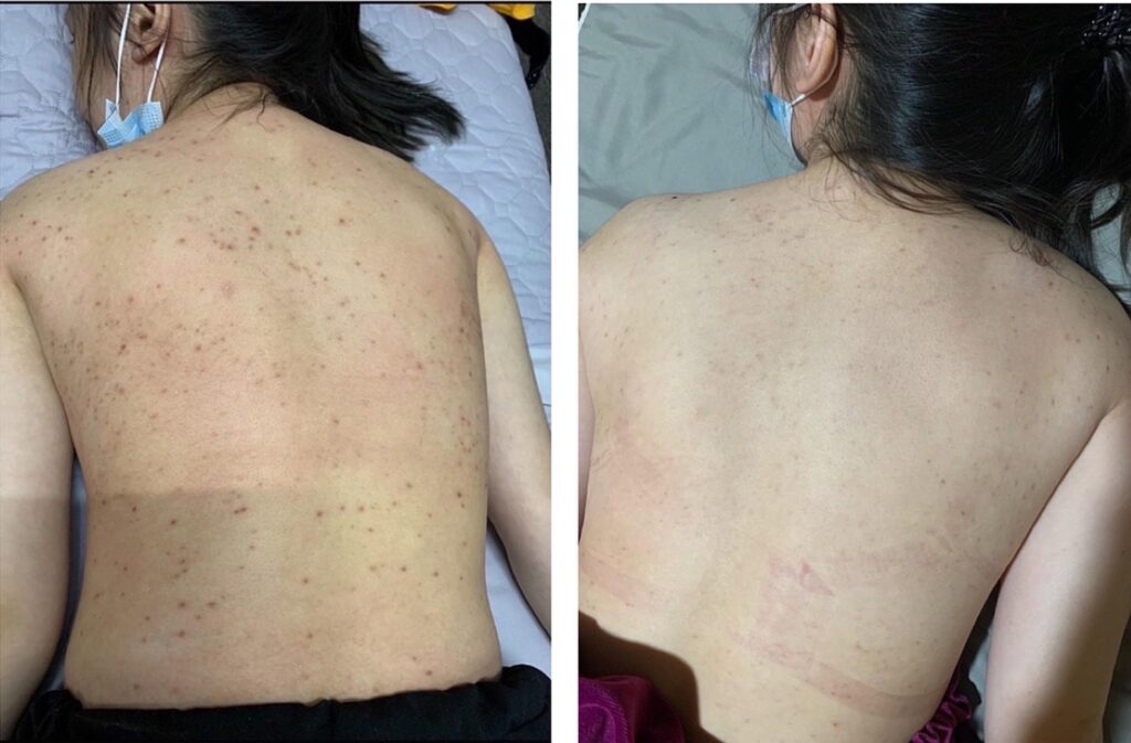 SKS Mall美背推荐